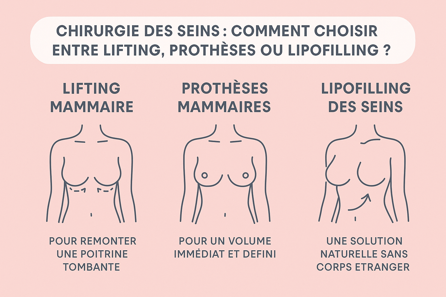 Chirurgie des seins : comment choisir entre lifting, prothèses ou lipofilling ?