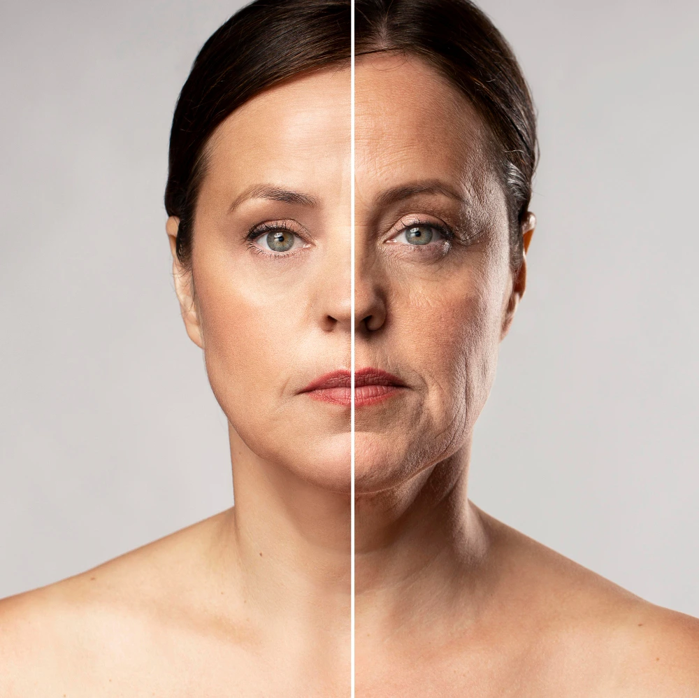 Résultat d'un lifting du visage en Tunisie pour un rajeunissement facial naturel