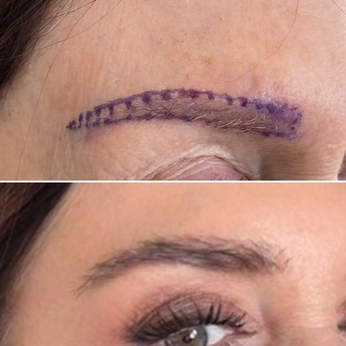 Greffe de sourcils Tunisie – densification sourcils esthétique homme/femme