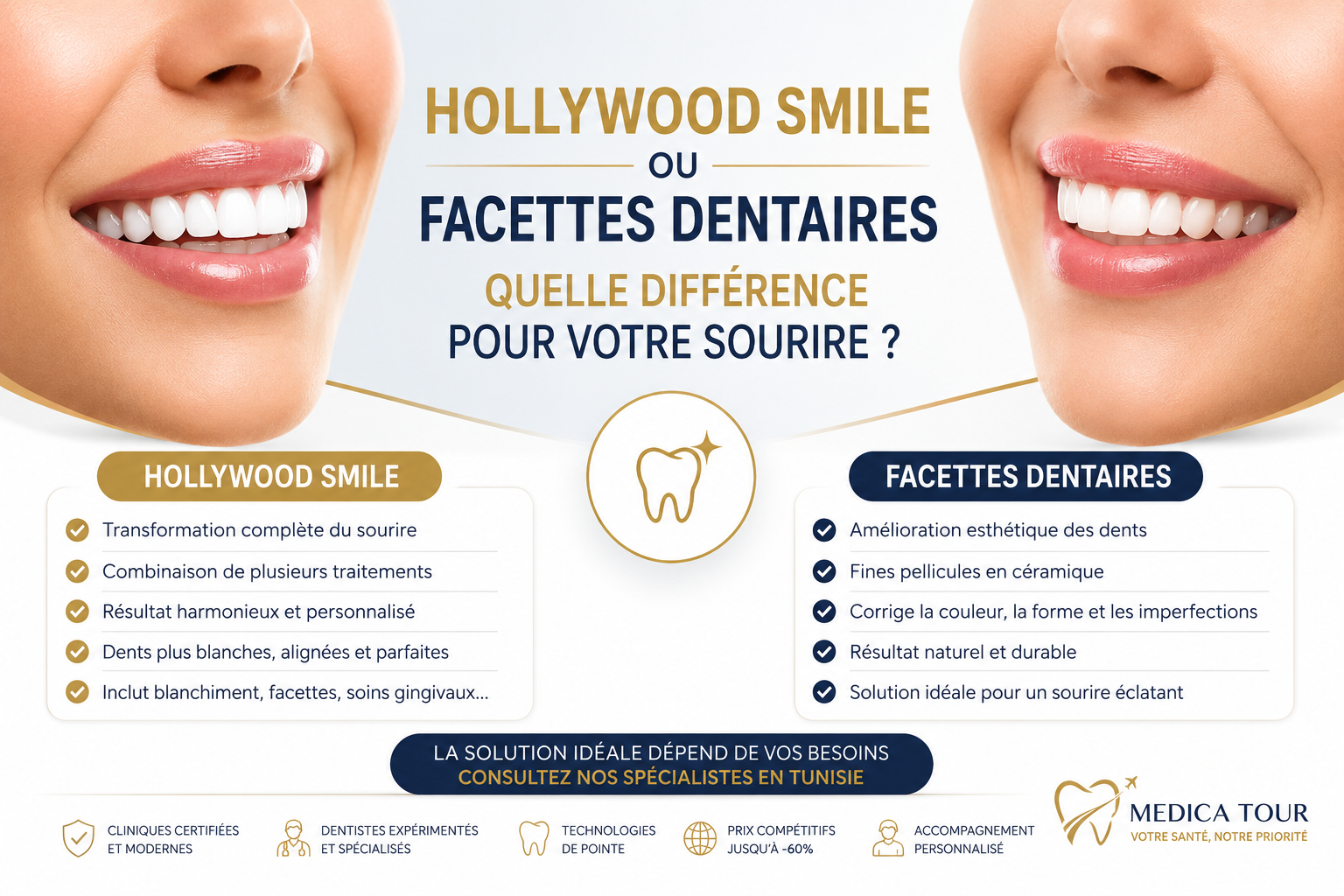 Hollywood Smile et facettes dentaires en Tunisie pour un sourire harmonieux et esthétique